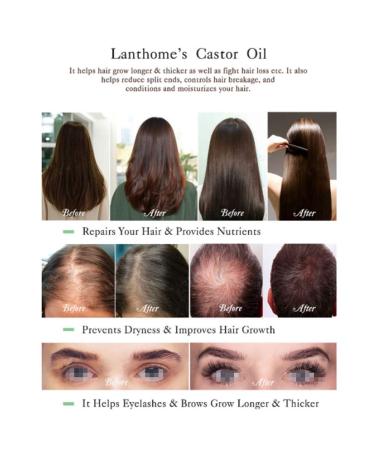 10ml Natural Castor Oil Hair Growth Serum - Essential Moisturizer for Eyebrow & Eyelash Nourishment | International Shipping - Buy Online on GoSupps.com