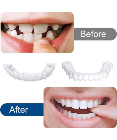 2 Pairs Instant Veneers - Upper & Lower Temporary Cosmetic Teeth | Reusable Whitening Provisional Dentures for Adults - Buy Online on GoSupps.com