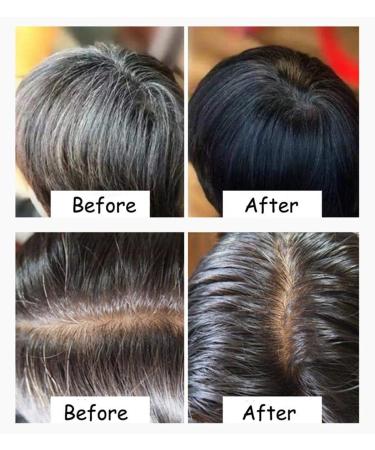 HUSHUI Natural Shampoo Bar for Hair Bamboo Charcoal Shampoo Bar Hair Darkening Shampoo Bar Anti Hair Loss Shampoo Bar Handmade - Buy Online on GoSupps.com
