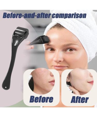 Micro Needling Roller Derma Roller Beard Growth Precision Micro-Needling Roller 540 Needles Stimulate Beard and Hair Growth Facial Skin Care 0.5mm Microneedle Roller(Black) - Buy Online on GoSupps.com