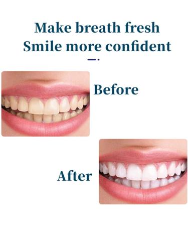 Yiliku SP-4 Probiotic Toothpaste - Teeth Whitener & Gum Protector Brightening Stain Removal (1/2/3 PCS) - Freshens Breath for Everyone - Buy Online on GoSupps.com