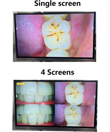 Intraoral Camera for Dental Observation | HDIM/VAG Interface | TV & Computer Display - Buy Online on GoSupps.com