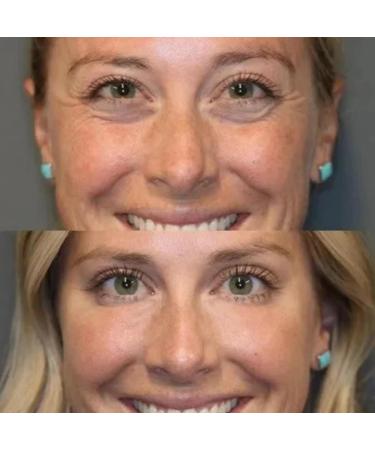 Celyn Instant Firm Eye Lift Pocket Cream - Anti-Aging Eye Cream for All Skin Types (2PCs) - Shop Internationally! - Buy Online on GoSupps.com