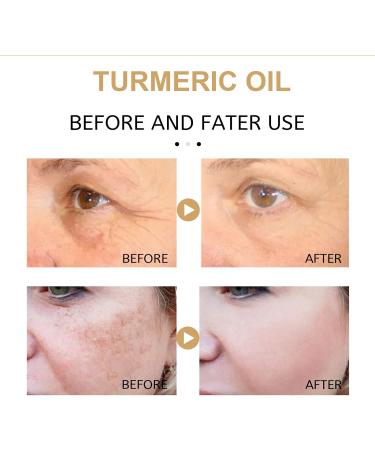 Turmeric Face Serums Oil Bright Skin Dark Spot Corrector Turmeric Serum Skin Care Moisturizing Repair Serum for Face and Body(30ML) - Buy Online on GoSupps.com
