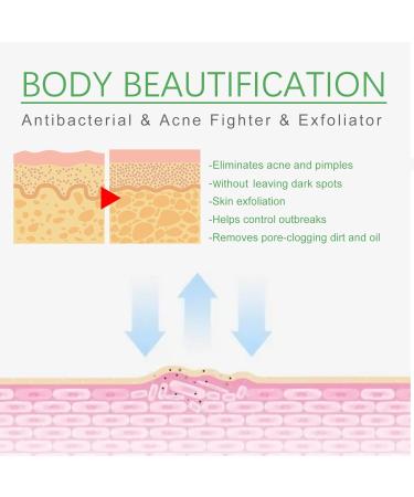 Trendyfave Dark Spot Correcting Glow Serum Skin Tag Removal Age Spot Remover For Face Scar Treatment Pore Minimizer Serums Skincare Contains Tea Tree Oil Vitamin E Body Acne Treatment 30ml - Buy Online on GoSupps.com