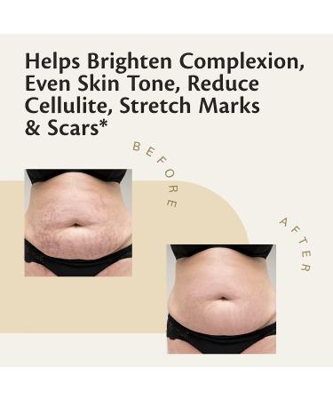 Kombucha Body Scrub with Collagen and Shea Butter | Exfoliating Skin Care by M3 Naturals - Buy Online on GoSupps.com