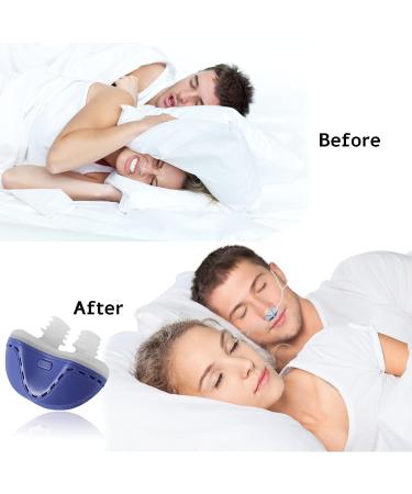 Cindiat Electric Anti-Snoring Device with Silicone Fixation Belt - Stop Snoring Solution for Men and Women (Blue) - Buy Online on GoSupps.com