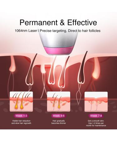 Upgraded Diode Laser Hair Removal for Dark Skin - DermRays 1064nm | Permanent Hair Reduction for All Skin Tones - Buy Online on GoSupps.com