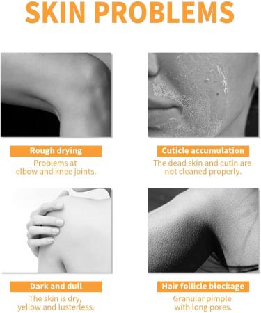 Exfoliant Profond Blanchissant La Papaye Skinetic Facial Peels Cream Gel Exfoliant La Papaye Deep Exfoliating Face Wash Natural Papaya Whitening Face Scrub for Improves Pore Dark Spot (2 Pcs) - Buy Online on GoSupps.com