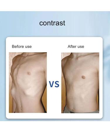 ZJchao Child Chest Corrector Rib Brace - Pectus Excavatum Support Detachable Design Breathable Fabric for Post Surgery Recovery - Buy Online on GoSupps.com