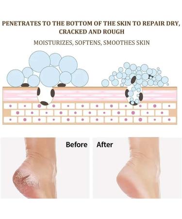 ENVVA Cracked Hands and Feet Cream Heel Balm Stick for Dry Cracked Feet Stick Heel Balm for Dry and Cracked Feet Intensive Moisturizing Foot Care - Buy Online on GoSupps.com