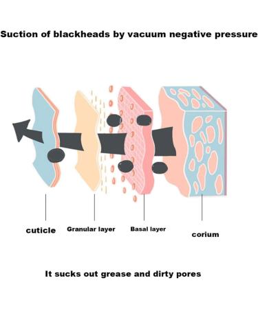 Luxury Confidence Keratin Remover Blackhead Remover Pore Vacuum Electric Face Vacuum Pore Cleaner White Heads Removal With 3 Modes And 4 Suction Heads Head Remover Creme (Pink One Size) One Size Pink - Buy Online on GoSupps.com