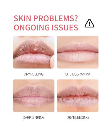 8 - piece Fruity Lip Mask Set! Paired with Lip Balm for Long - lasting Moisturization - Buy Online on GoSupps.com