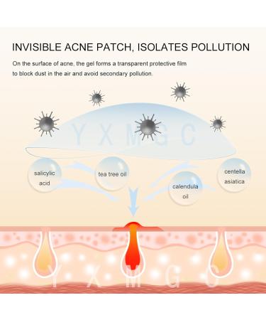 Acne Pimple Patch - Hydrocolloid Treatment with Tea Tree Oil Natural Ingredients & 240 Patches for Whiteheads Blackheads & Blemishes - Buy Online on GoSupps.com