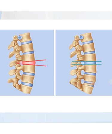 Lumbar Support Brace | Adjustable Lower Back Support Breathable Lumbar Supports Accessories Multipurpose Waist Supports Tool for Indoor Home Living Room - Buy Online on GoSupps.com