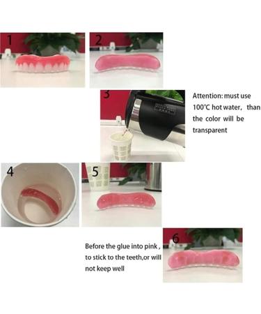 MXRFACTORY Instant Veneers Peetel Gel - Comfortable Removable Cosmetic Dentures for Broken Teeth | Reusable Upper & Lower 2 Pairs for Men & Women - Buy Online on GoSupps.com