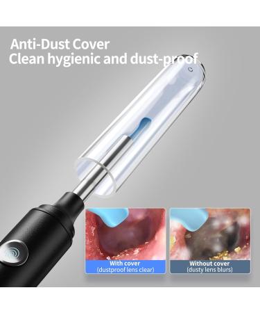 Hopefox 1080P Ear Wax Removal Kit Camera | WiFi Otoscope for iPhone, iPad & Android | 6 LED Lights | Ear Cleaning Tool with Dust Cover - Buy Online on GoSupps.com