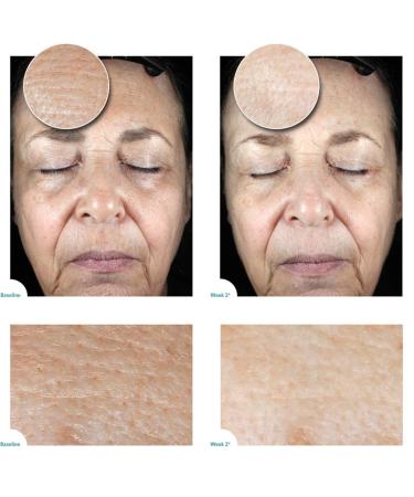 Satin Bright Soft Water Peel - 95% Organic Korean Exfoliator for Anti-Aging Acne Dry Oily & Sensitive Skin | 100 ml Gommage - Buy Online on GoSupps.com