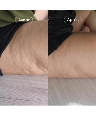 OMUM - Slimming Cellulite and Firmness Dietary Supplement - 60 Capsules 1 Month - Coach Action 3-in-1 Proven Effectiveness Affine Tones Drains - Natural Made in France Vegan Breastfeeding - Buy Online on GoSupps.com