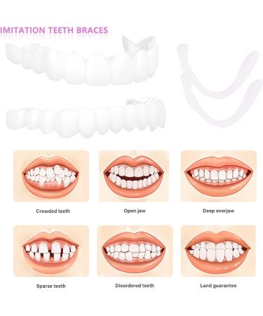 Snap-On Smile Instant Veneers - Top & Bottom Fake Teeth Dentures - Buy Online on GoSupps.com