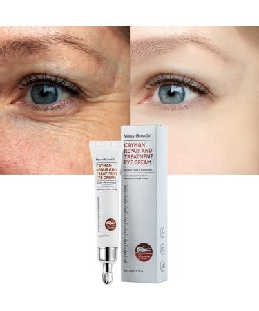 Magic Eye Cream  Instantly Remove Under Eye Bags Wrinkles Puffiness Dark Circles and Fine Lines  Anti Aging Eye Cream white