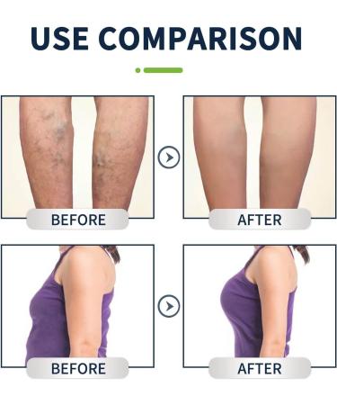 Herbal Soothing Foot Soak Beads Herbal Detox Cleansing Foot Soak Beads Herbal Foot Cleansing Soak Beads Herbal Detox and Shaping Foot Soak Beads Foot Care 10Beads/Bag (3 Bags) - Buy Online on GoSupps.com