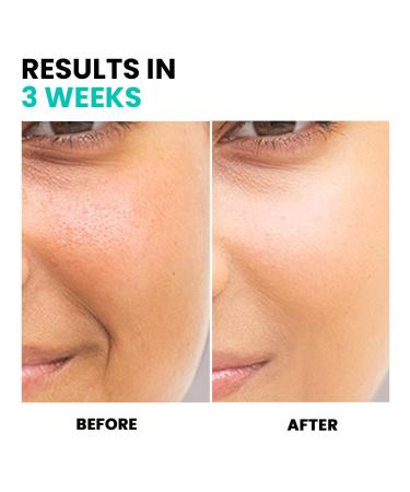 Conatural Vitamin C Face Wash 150ml - Sulfate-Free Paraben-Free Brightening Cleanser for Radiant Skin - Natural Hydrating & Gentle for All Skin Types - Buy Online on GoSupps.com