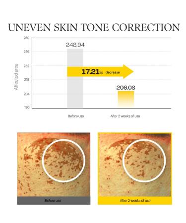 d'alba Piedmont Vita Toning capsule Cream Deep Hydration Face Moisturizer Glass Skin with Vita-Cera Oil Capsules Deep Hydration Face Moisturizer (1.94 oz.) JAR VITA - Buy Online on GoSupps.com