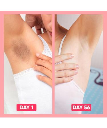 Dear Kitty Intimate Serum Evening Cream - Natural Dark Spot Corrector for Private & Sensitive Areas - Underarm Skin Improving Cream (1oz) - Buy Online on GoSupps.com