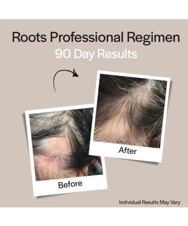 Founder s Formula Scalp Topical Therapy | Best Hair Loss Treatment | Stimulate Hair Growth with Caffeine Ginseng Saw Palmetto & DHT Blockers | 3 Fl Oz - International Shipping Available - Buy Online on GoSupps.com