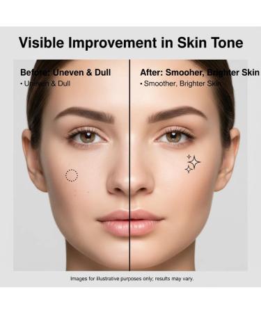 KUPOINEA Dark Spot Remover for Face and Body Serum: Advanced Formula Spot Corrector Cream with Niacinamide Age Spot Sun Spot Freckles Melasma Brown Spot - for Women and Men (1.0 Fl Oz) - Buy Online on GoSupps.com