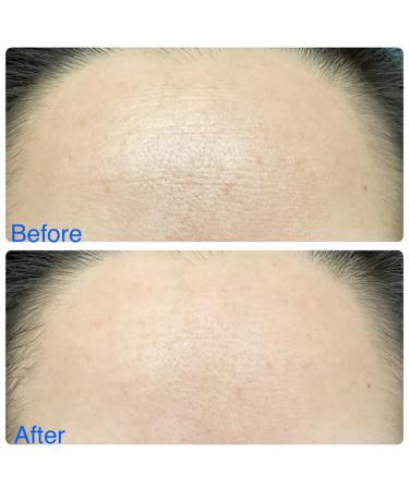 UOG Collagen Complex - Anti-Wrinkle Essence for Face & Neck | Firming & Lifting Moisturizer | Hydrating for All Skin Types - 30ml - Buy Online on GoSupps.com