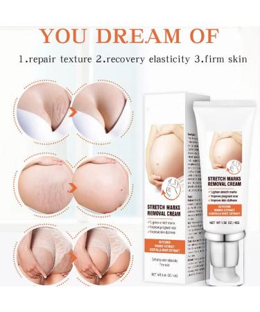 Stretch Marks Fading Cream Cr me claircissante vergetures Cr me Vergetures Cr me Cicatrice Anti-vergetures Cr me Cr me R paratrice pour La Peau Cr me Hydratante Le Corps Enl ve Les Cicatrices - Buy Online on GoSupps.com