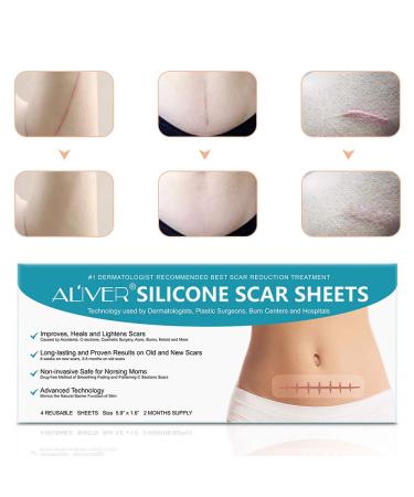 Silicone Scar Sheets - Reusable Treatment Strips for Keloids, C-Section, Surgery, Burns, and Acne - 4 Sheets - 5.9x1.6 - Best for Scar Reduction - Buy Online on GoSupps.com