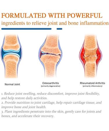 ZANLION Cvreoz Australian Honey Bee Venom Pain and Bone Healing Cream Fivfivgo Bee Venom Pain Cream with Australian Honey Bee Venom Bee Venom Cream for Pain New Zealand Bee Venom Gel (1 Pc) - Buy Online on GoSupps.com