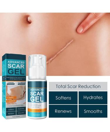 Scar Removal Cream Gel - Natural Extract for Brightening & Reducing Surgical Scars - Buy Online on GoSupps.com