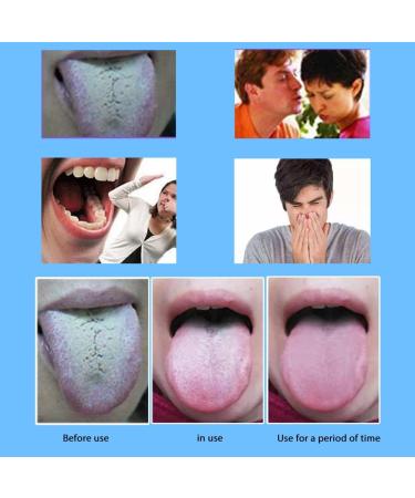 Zhongdawei Tongue Scraper - 5 Pack Plastic Tongue Cleaners for Adults & Kids | Reduce Bad Breath - Buy Online on GoSupps.com