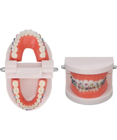 Tooth Demonstration Model - Dental Typodont with Orthodontic Bracket for Dentist Research | International Shipping - Buy Online on GoSupps.com