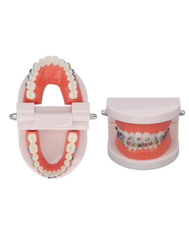 ANGGREK Dental Typodontic Tooth Model with Orthodontic Metal Mount | Ideal for Teaching & Research - International Shipping Available - Buy Online on GoSupps.com