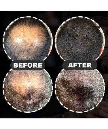 HAIRGAIN Hair Fibre - 28g Bottle for Thin Hair - Natural & Undetectable Hair Loss Concealer - Thickening Fibre Topper for Men & Women (Auburn) - Buy Online on GoSupps.com