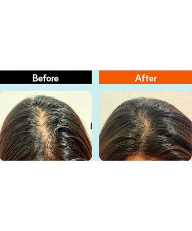 WHITESILK (100ml) THE SCM 85 (human stem cell) + HGF Therapy Anti-Hair Loss Hair Scalp EXPERT Serum Promotes Growth and Lessens Hair Loss with SCM-3D Biomimetic Technology - Buy Online on GoSupps.com