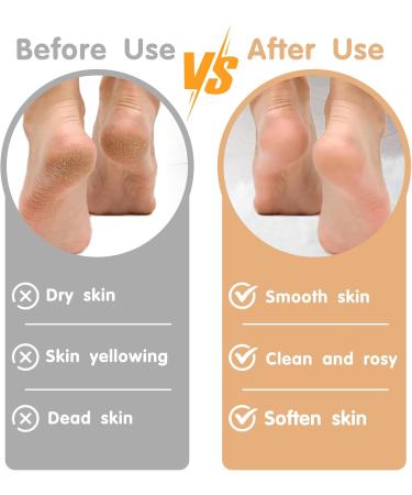 Foot Files for Hard Skin - Foot File Foot Scraper Gentle Hard Skin and Callus Removal Remover for Cracked Heels and Foot Scraper for Soft & Smooth Heels Foot Scrubber Not Hurt Your Feet - Buy Online on GoSupps.com