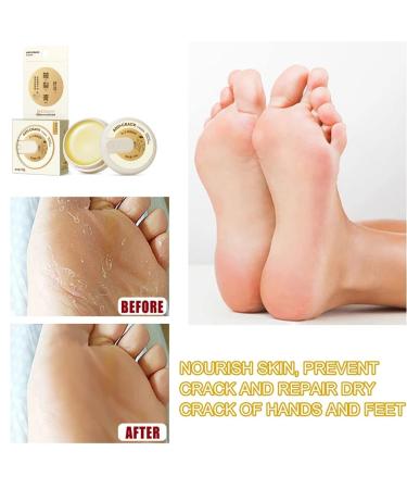 Natural Anti-Cracking Frost Repair Cream for Hands & Feet | Cracked Skin Relief & Regeneration | Winter Skin Care - Buy Online on GoSupps.com