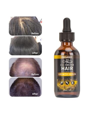 M&A Organic Anti Hair Loss Serum 60ml | Hair Growth Solution | International Shipping - Buy Online on GoSupps.com