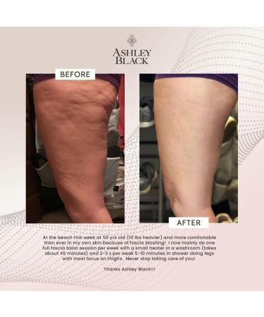FasciaBlaster Trigger Point Tools by Ashley Black for Recovery & Anti-Cellulite - Skin Soothing Fascia Tool - Buy Online on GoSupps.com
