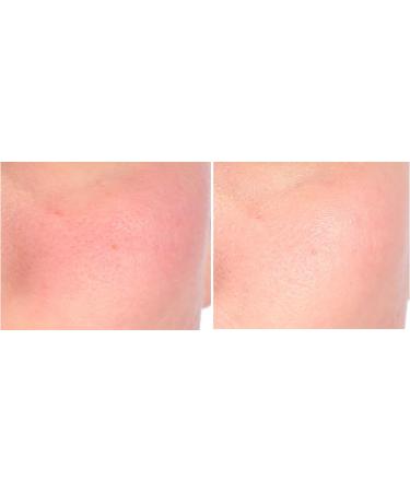 Nakery Intensive Repair Treatment Eczema Relief Cream | 2% Colloidal Oatmeal | Face & Body Soothing | Immediate Relief - Buy Online on GoSupps.com