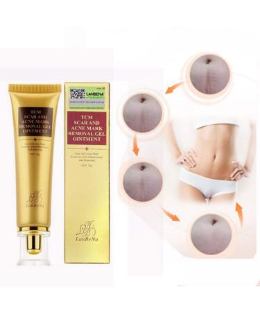 Symeas Scar & Acne Removal Cream - Effective Treatment for Stretch Marks Keloid Skin & Burns - 30g - Buy Online on GoSupps.com