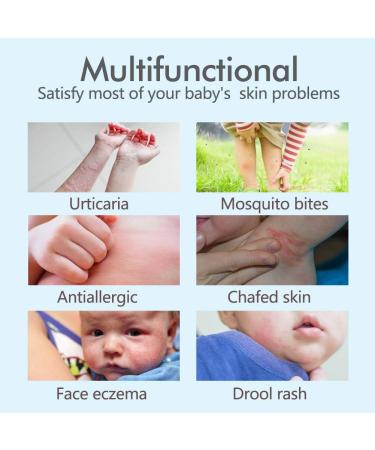Natural Eczema & Urticaria Treatment Diaper Rash Cream for Babies - Mingmei Herbal Formula 1.5oz - Buy Online on GoSupps.com