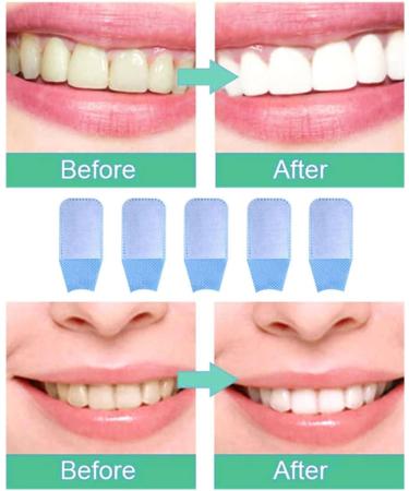 Finger Teeth Wipes - 10PCS Oral Hygiene Cleaning Wipes for Fresh Breath & Healthy Teeth - Buy Online on GoSupps.com