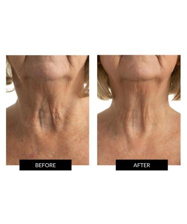 CurrentBody Skin Face Neck & D collet Set - Luxury Skincare Bundle for Radiant Skin | International Shipping Available - Buy Online on GoSupps.com